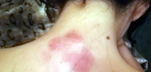 ДЕВОЈКА ДОБИЛА БАТИНЕ У НОЋНОМ КЛУБУ: Полицајац ме тукао два пута (ФОТО)